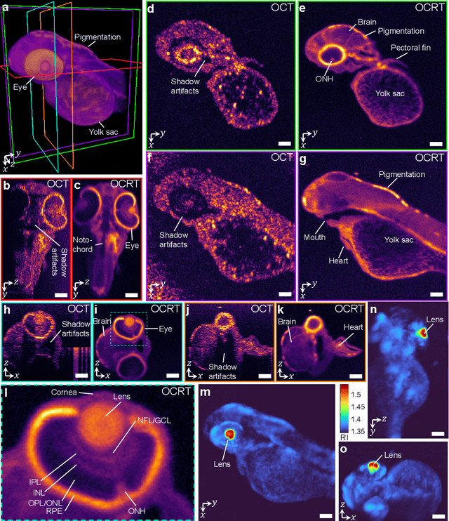 Figure 3 for Computational 3D microscopy with optical coherence refraction tomography