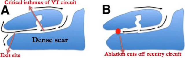 Figure 1 for Learning disentangled representation from 12-lead electrograms: application in localizing the origin of Ventricular Tachycardia