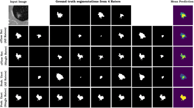 Figure 4 for Uncertainty quantification in medical image segmentation with Normalizing Flows