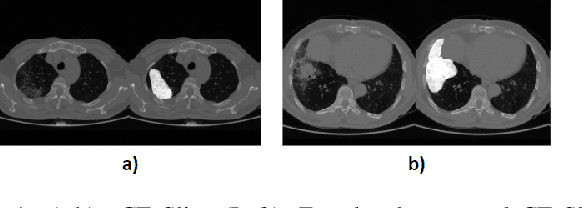 Figure 1 for Comparative Evaluation of 3D and 2D Deep Learning Techniques for Semantic Segmentation in CT Scans