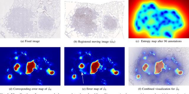 Figure 4 for Uncertainty-Aware Annotation Protocol to Evaluate Deformable Registration Algorithms