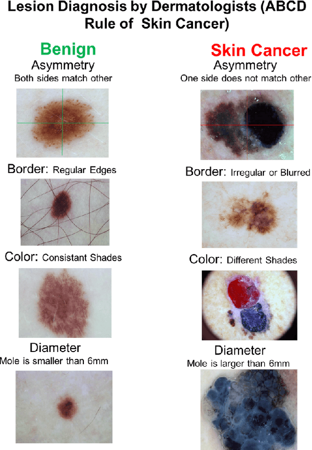 Figure 1 for Automatic Lesion Boundary Segmentation in Dermoscopic Images with Ensemble Deep Learning Methods