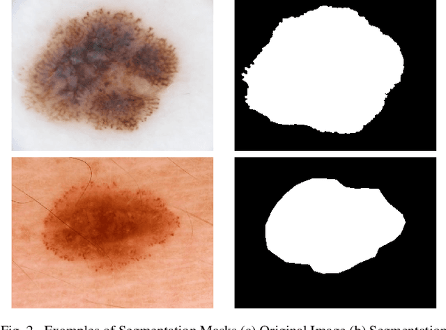 Figure 2 for Automatic Lesion Boundary Segmentation in Dermoscopic Images with Ensemble Deep Learning Methods