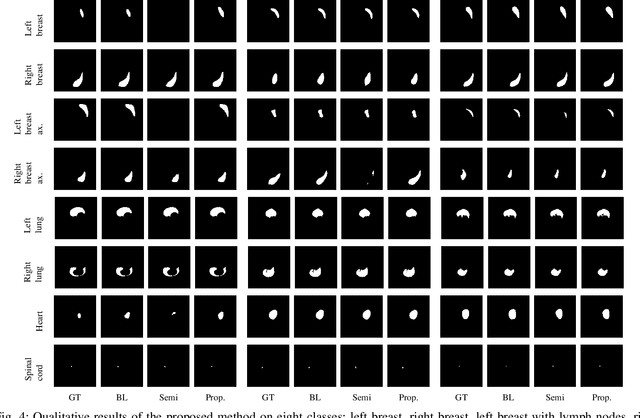 Figure 4 for A Data-Adaptive Loss Function for Incomplete Data and Incremental Learning in Semantic Image Segmentation