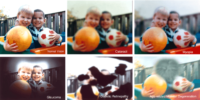 Figure 1 for The relationship between Fully Connected Layers and number of classes for the analysis of retinal images