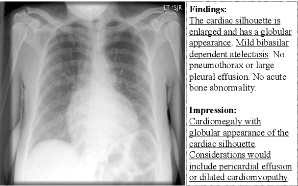 Figure 1 for Show, Describe and Conclude: On Exploiting the Structure Information of Chest X-Ray Reports