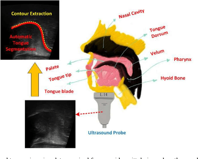 Figure 1 for BowNet: Dilated Convolution Neural Network for Ultrasound Tongue Contour Extraction