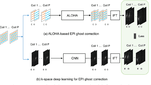 Figure 1 for k-Space Deep Learning for Reference-free EPI Ghost Correction