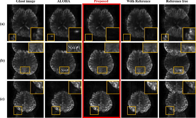 Figure 4 for k-Space Deep Learning for Reference-free EPI Ghost Correction