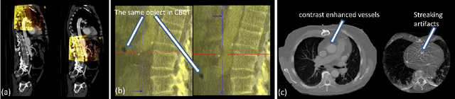 Figure 1 for An Artificial Agent for Robust Image Registration