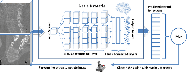 Figure 3 for An Artificial Agent for Robust Image Registration