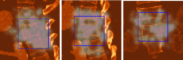 Figure 4 for An Artificial Agent for Robust Image Registration