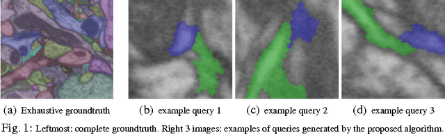 Figure 1 for Small Sample Learning of Superpixel Classifiers for EM Segmentation- Extended Version