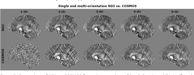 Figure 3 for Nonlinear Dipole Inversion (NDI) enables Quantitative Susceptibility Mapping (QSM) without parameter tuning