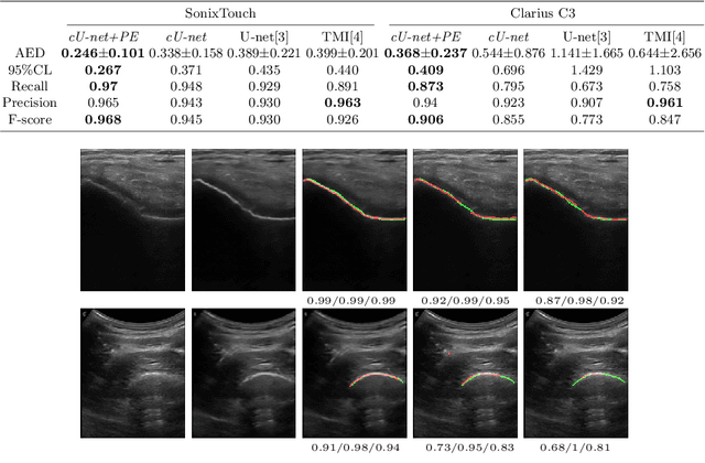 Figure 3 for Simultaneous Segmentation and Classification of Bone Surfaces from Ultrasound Using a Multi-feature Guided CNN