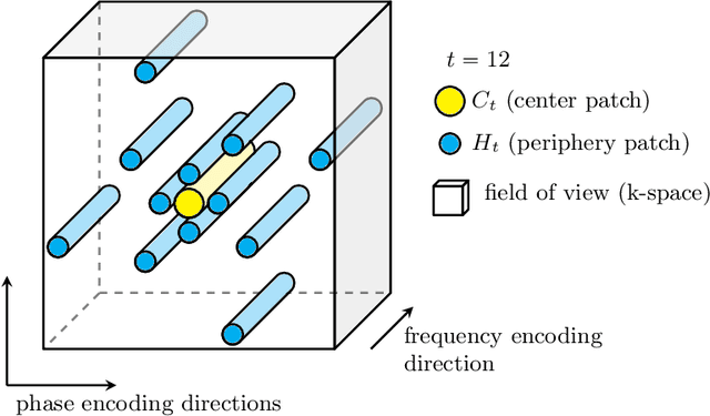 Figure 1 for Accelerated Motion-Aware MR Imaging via Motion Prediction from K-Space Center