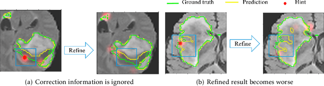 Figure 3 for Interactive Medical Image Segmentation with Self-Adaptive Confidence Calibration