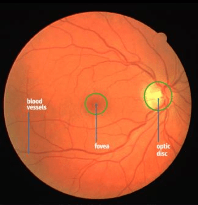 Figure 1 for Segmentation of optic disc, fovea and retinal vasculature using a single convolutional neural network