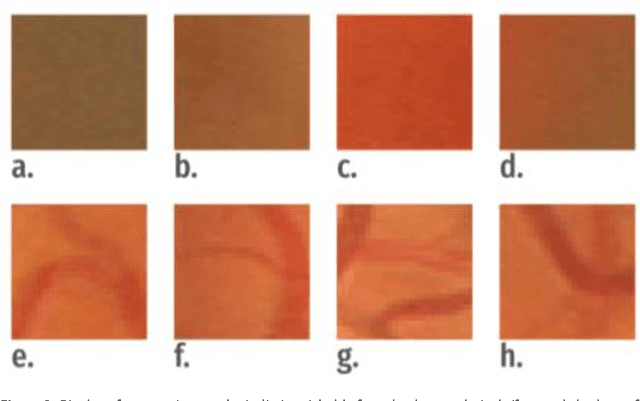 Figure 3 for Segmentation of optic disc, fovea and retinal vasculature using a single convolutional neural network