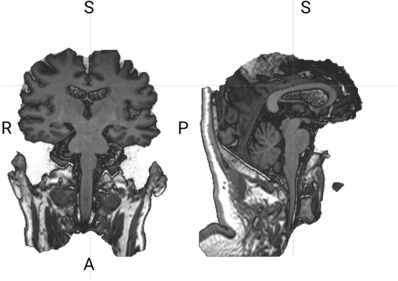 Figure 4 for 3D Deep Learning on Medical Images: A Review