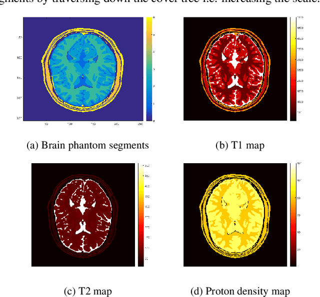 Figure 3 for Cover Tree Compressed Sensing for Fast MR Fingerprint Recovery