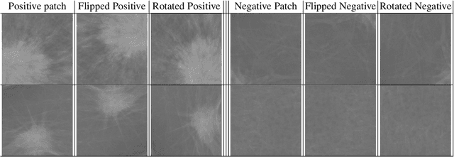 Figure 4 for Automatic Mass Detection in Breast Using Deep Convolutional Neural Network and SVM Classifier