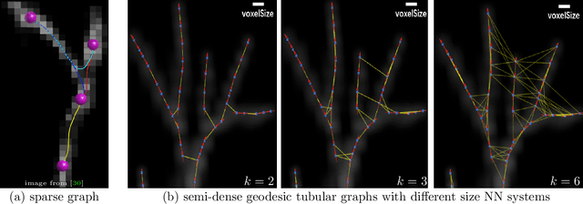 Figure 4 for Confluent Vessel Trees with Accurate Bifurcations