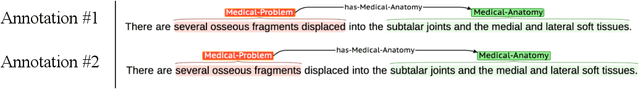 Figure 3 for Event-based clinical findings extraction from radiology reports with pre-trained language model