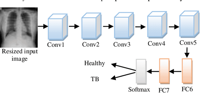 Figure 1 for Deep Learning for Automated Screening of Tuberculosis from Indian Chest X-rays: Analysis and Update