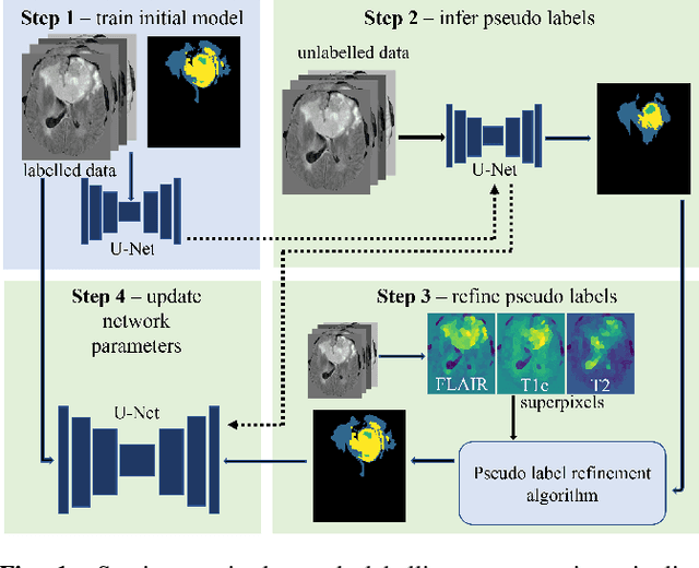 Figure 1 for Pseudo-label refinement using superpixels for semi-supervised brain tumour segmentation