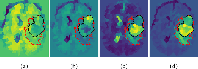 Figure 3 for Pseudo-label refinement using superpixels for semi-supervised brain tumour segmentation