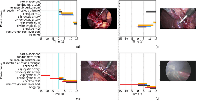 Figure 3 for SUrgical PRediction GAN for Events Anticipation