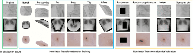 Figure 3 for Margin-Aware Intra-Class Novelty Identification for Medical Images