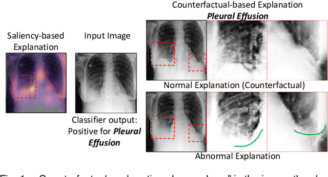 Figure 1 for Explaining the Black-box Smoothly- A Counterfactual Approach