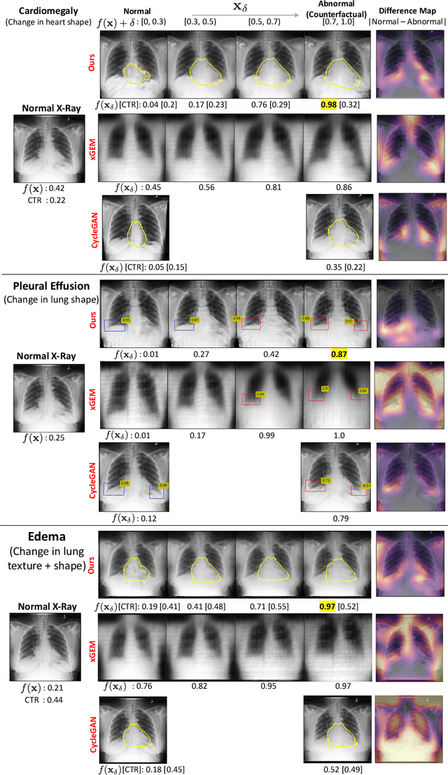 Figure 4 for Explaining the Black-box Smoothly- A Counterfactual Approach