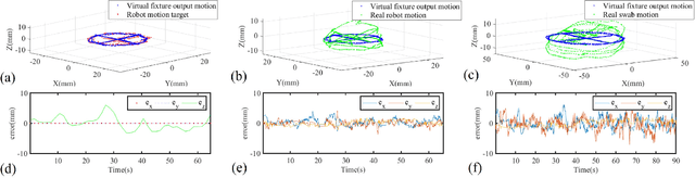 Figure 2 for Tele-Operated Oropharyngeal Swab (TOOS) RobotEnabled by TSS Soft Hand for Safe and EffectiveCOVID-19 OP Sampling
