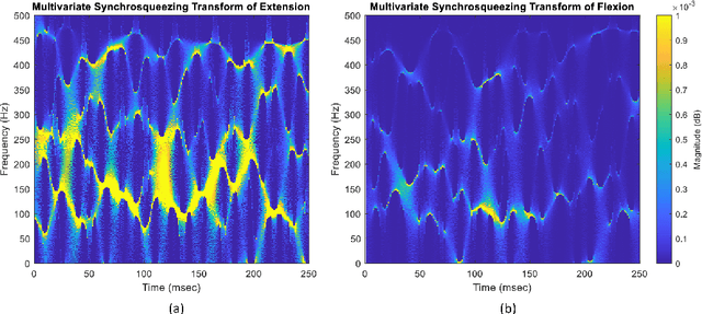 Figure 2 for Statistical Analysis of Time-Frequency Features Based On Multivariate Synchrosqueezing Transform for Hand Gesture Classification