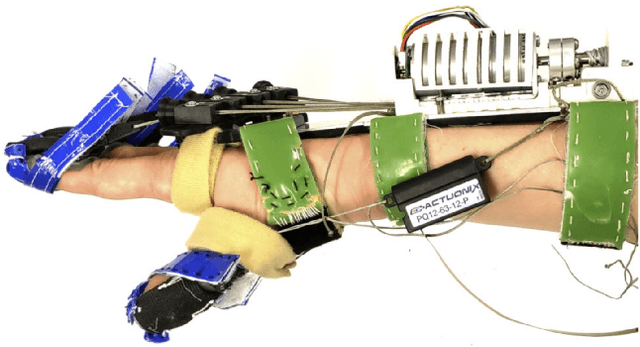Figure 1 for Thumb Assistance Via Active and Passive Exotendons in a Robotic Hand Orthosis for Stroke