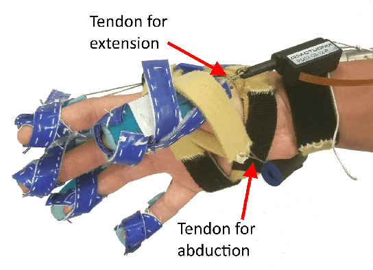 Figure 2 for Thumb Assistance Via Active and Passive Exotendons in a Robotic Hand Orthosis for Stroke