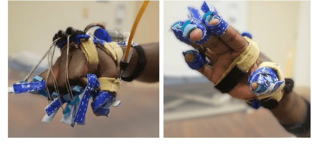 Figure 3 for Thumb Assistance Via Active and Passive Exotendons in a Robotic Hand Orthosis for Stroke