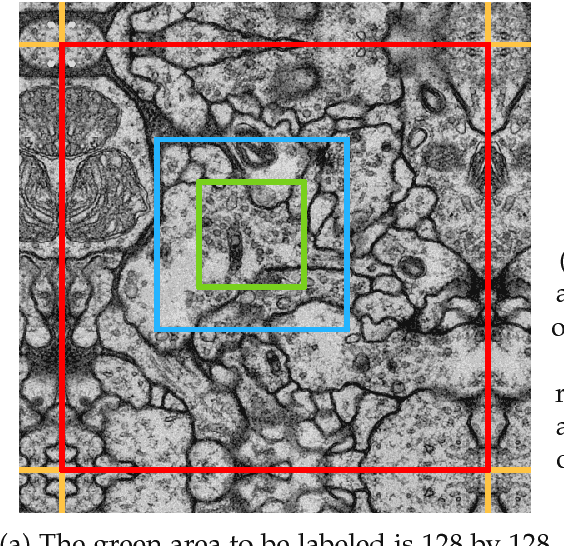 Figure 2 for Efficient Convolutional Neural Networks for Pixelwise Classification on Heterogeneous Hardware Systems