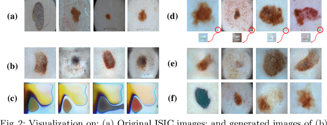 Figure 3 for Backdoor Attack is A Devil in Federated GAN-based Medical Image Synthesis