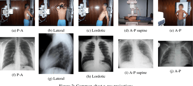 Figure 3 for PadChest: A large chest x-ray image dataset with multi-label annotated reports