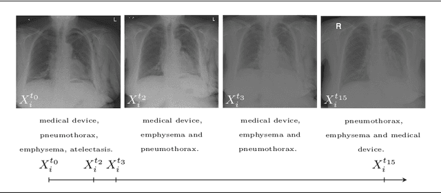 Figure 1 for Longitudinal detection of radiological abnormalities with time-modulated LSTM