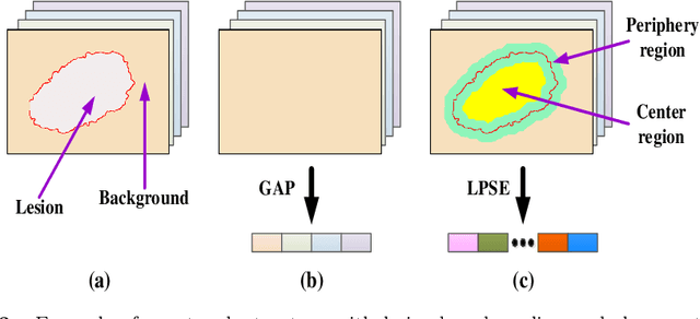 Figure 4 for Knowledge-aware Deep Framework for Collaborative Skin Lesion Segmentation and Melanoma Recognition