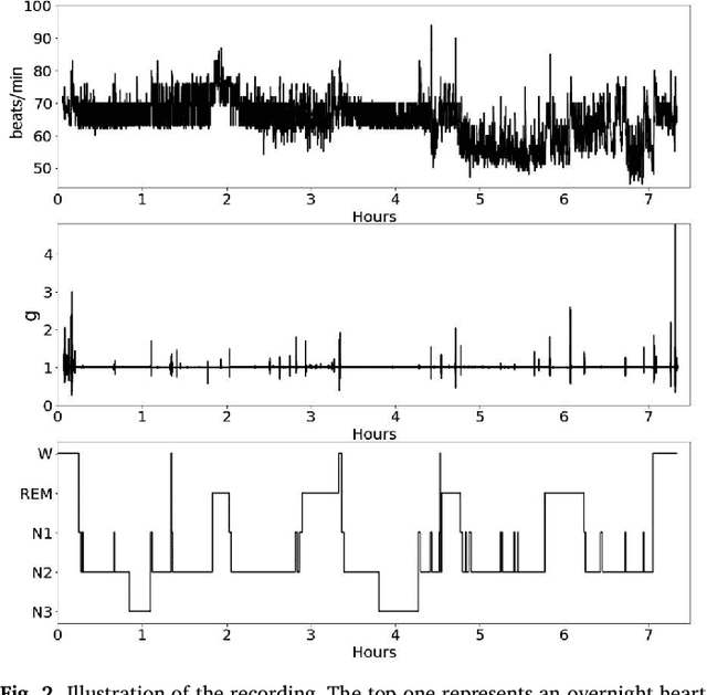 Figure 3 for Sleep Stage Classification Based on Multi-level Feature Learning and Recurrent Neural Networks via Wearable Device