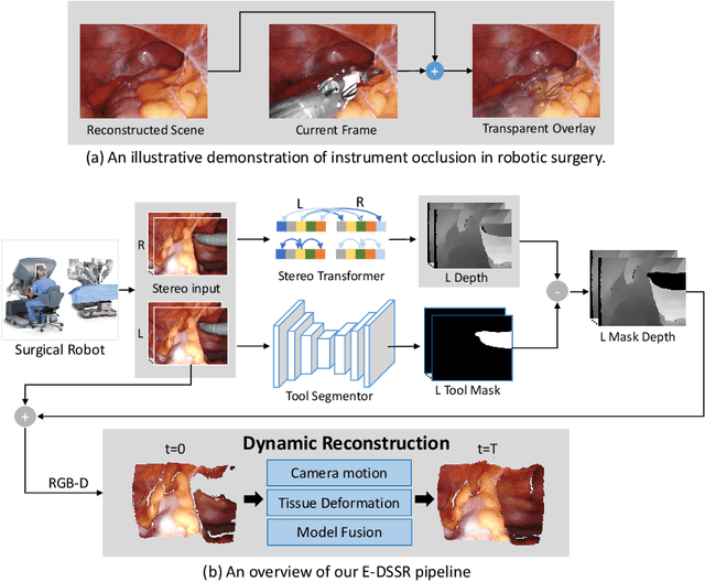 Figure 1 for E-DSSR: Efficient Dynamic Surgical Scene Reconstruction with Transformer-based Stereoscopic Depth Perception