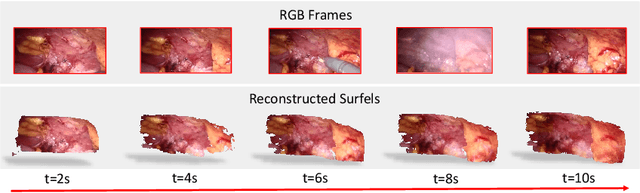 Figure 4 for E-DSSR: Efficient Dynamic Surgical Scene Reconstruction with Transformer-based Stereoscopic Depth Perception