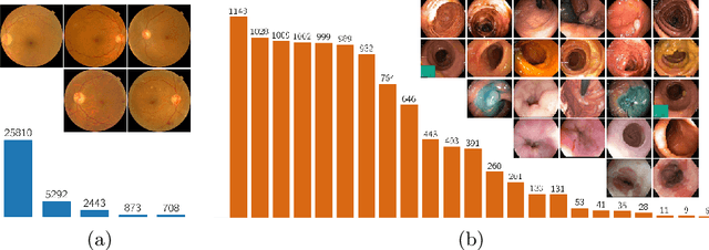 Figure 1 for Balanced-MixUp for Highly Imbalanced Medical Image Classification