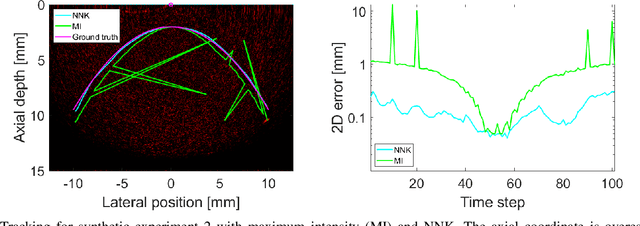 Figure 4 for Neural Network Kalman filtering for 3D object tracking from linear array ultrasound data